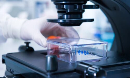 Mladých s rakovinou přibývá. Vědci tápou, co se změnilo, teď ale mají novou naději