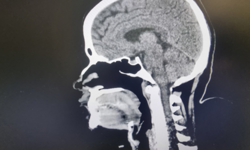 Jak se bránit „hnilobě mozku“? Vědci zkoumají nový fenomén spojený s prohlížením internetu