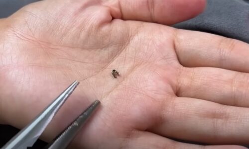 Zips sa rozchádza a bunda sa nedá zapnúť? Tento rýchly krajčírsky trik funguje aj vtedy, keď chýbajú alebo sa deformovali zuby