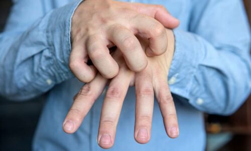 Nemocné Česko: Svrab, spalničky či černý kašel jsou na vzestupu. Nákazu hlásí i škola v Sušici Nemocné Česko: Svrab, spalničky či černý kašel jsou na vzestupu. Nákazu hlásí i škola v Sušici