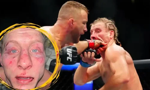 Tvár Pimbletta po zápase s Gaethjem na UFC 324 bola na nespoznanie. Tieto výplaty si za súboj odniesli