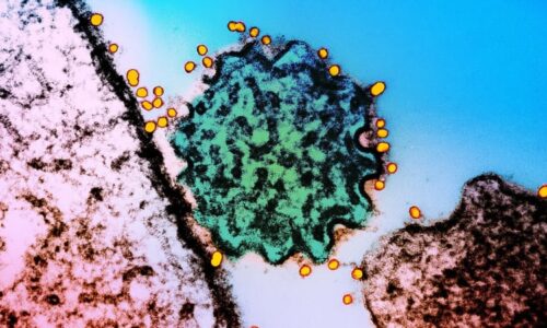 Smrtící virus Nipah PŘEHLEDNĚ: Jaké jsou příznaky, jak se šíří a proč je tak nebezpečný?