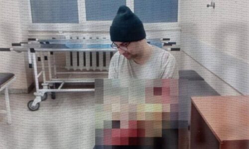 Na Ukrajine sa muž pokúsil odpíliť si ruku