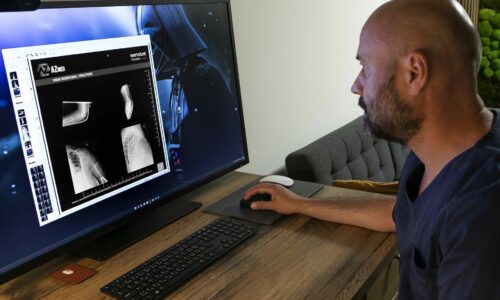 V strednej a východnej Európe chýbajú pravidlá na zodpovedné používanie umelej inteligencie