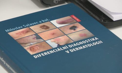 Lupénka a plísně ničí Čechům zdraví. Napadají i vnitřní orgány, varuje před nebezpečím lékař