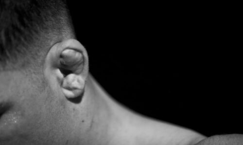 Nový riskantní TikTok trend: „Květákové uši“ lákají na drsnou vizáž, hrozí trvalé následky