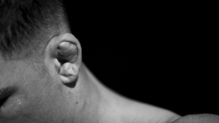 Riskantní tiktok trend: „květákové uši“ lákají na drsnou vizáž, hrozí trvalé následky