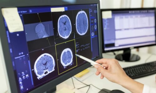 Mozek vám lže, odhalila studie. Upravuje vzpomínky tak, abyste si připadali lepší a schopnější