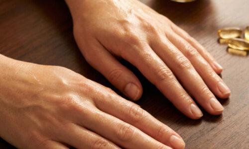 Kozmetička to radí každému, koho trápia pigmentové škvrny na rukách: S týmto zázrakom miznú za 24 hodín a pokožka skrásnie!