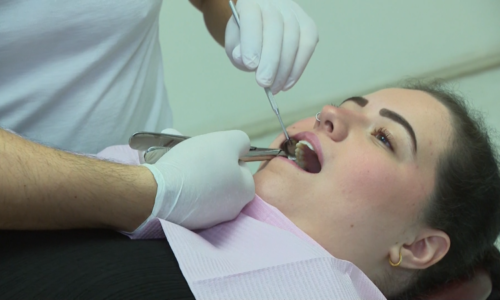 Bolest, která nedá člověku spát. Lékaři varují před častou chybou pacientů se zuby moudrosti