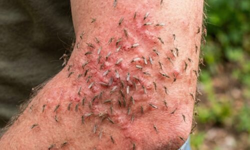 Stačí pár kvapiek tejto domácej tinktúry a môžete pokojne sedieť pri ohni bez toho, aby ste museli celú noc mávať rukami okolo svojej hlavy!