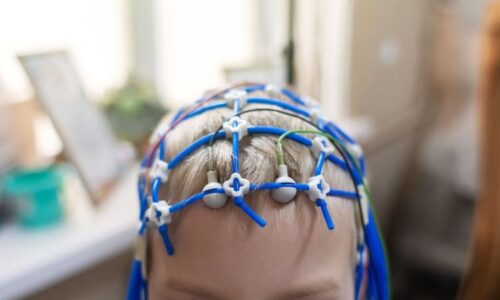 Jolaně s epilepsií pomohla operace, Patrik měl i sto záchvatů denně. Jak podat první pomoc?